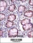 TARDBP Antibody (N-term)